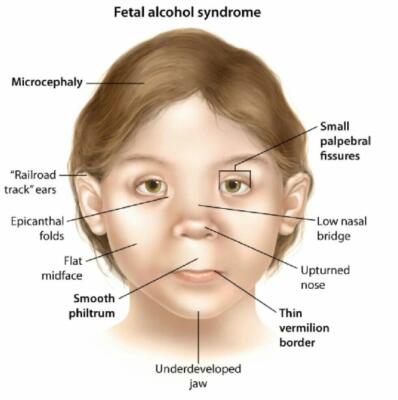 abnormal facial 