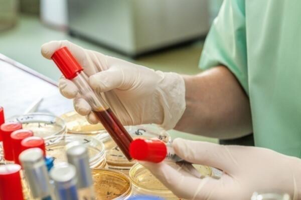 blood test