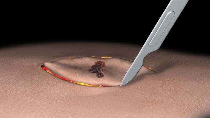health tissue
