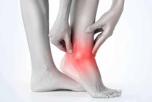sprains