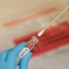 Coronavirus Testing Kit - Home Sample Collection