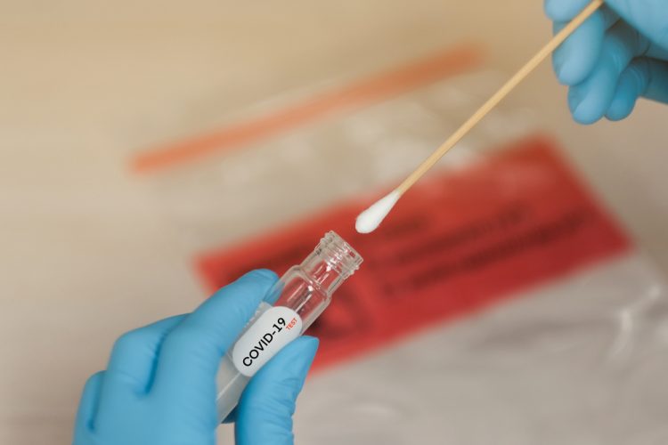 Coronavirus Testing Kit - Home Sample Collection